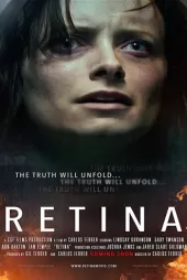Retina 